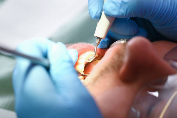 Best Holiday Emergency Dentist in Whitehall, MI